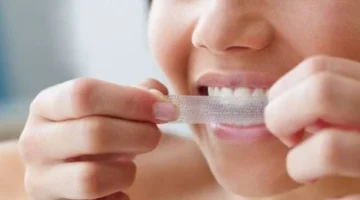شرائط تبييض الأسنان: كيف تحصل على ابتسامة ناصعة دون الإضرار بمينا الأسنان